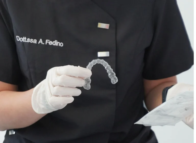 Come si spostano i denti con le mascherine trasparenti